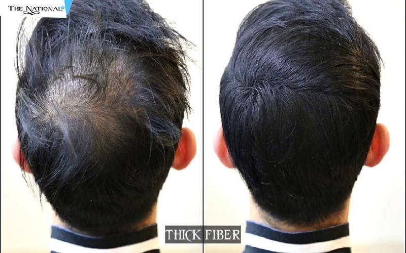 What Causes Hair Loss in Men? How to Use Hair Fibers to Cover Bald Spots?