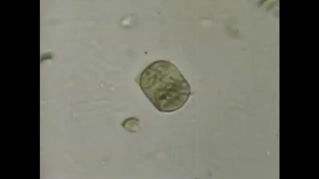 1970s: singled celled organism under microscope. Blue green algae under ...