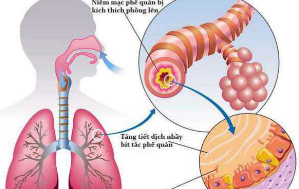 Phòng bệnh thường gặp trong mùa mưa bão