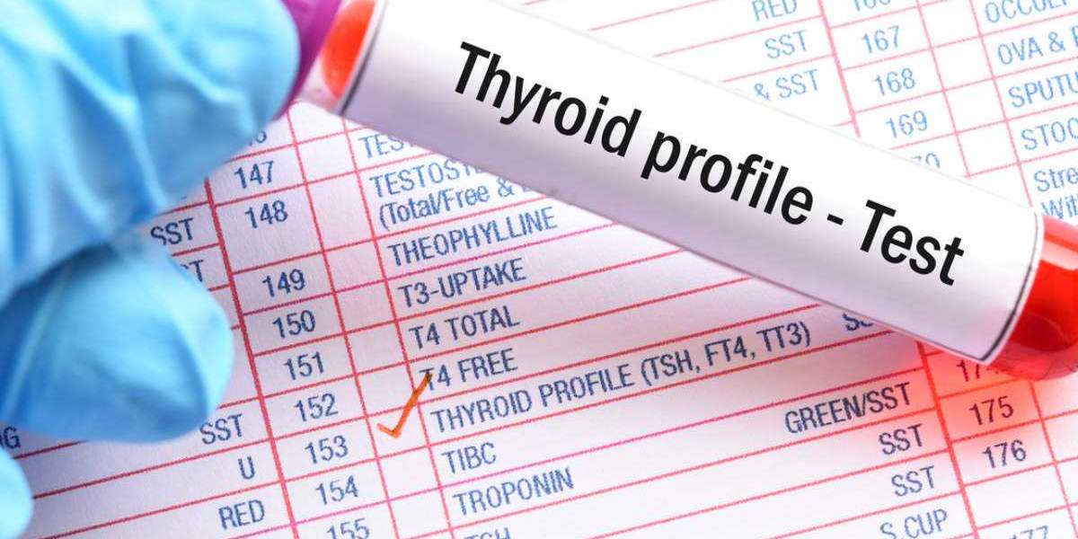 Thyroid Test Types That you simply Need to Know