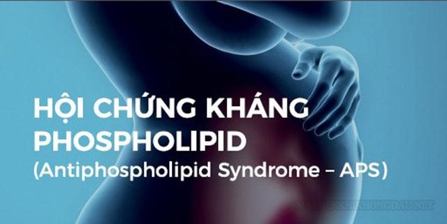 Mẹ bầu bị hội chứng kháng phospholipid có nguy hiểm không?