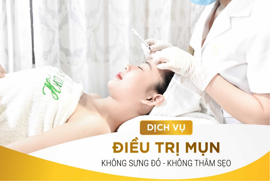 ĐIỀU TRỊ MỤN HIỆU QUẢ CAO KHÔNG THÂM SẸO KHÔNG TÁI PHÁT