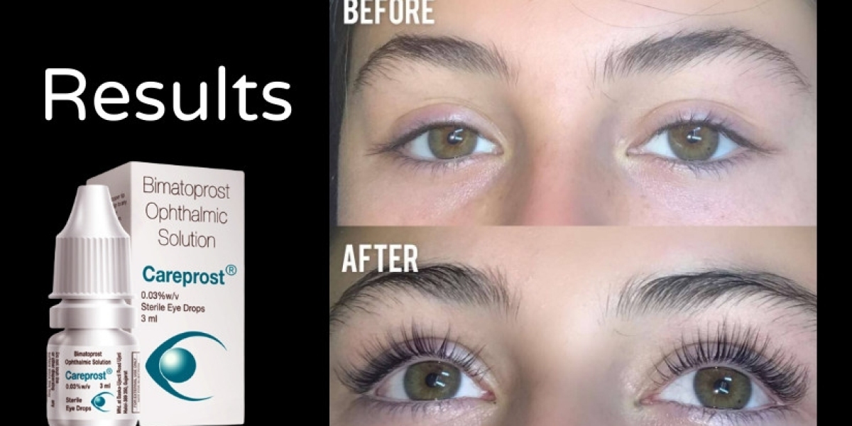 Careprost Eyelash Serum : Grow Eyelash Naturally Longer And Thicker