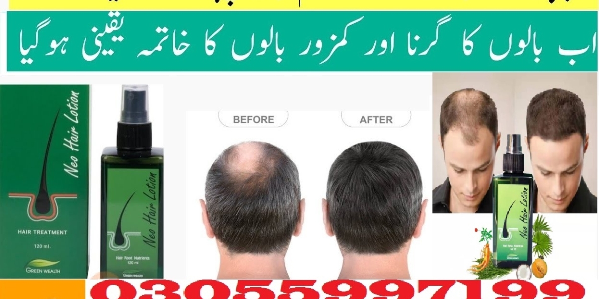 Neo Hair Lotion Price in Peshawar | 03055997199 | Green Wealth Neo Hair Lotion