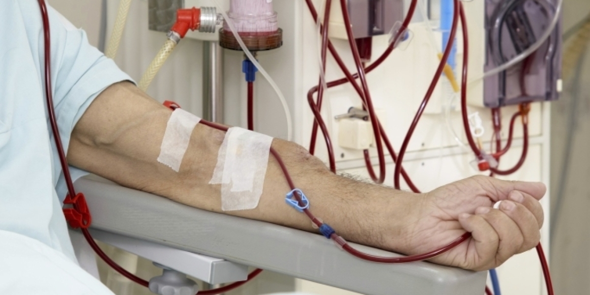 Hemodialysis Market 2023 | Industry Trends, Report Analysis and Forecast 2028