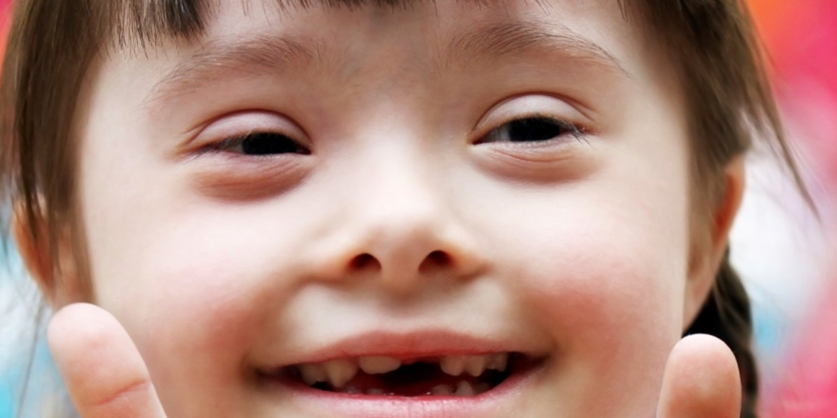 2023 Down Syndrome Market | Report By 2033