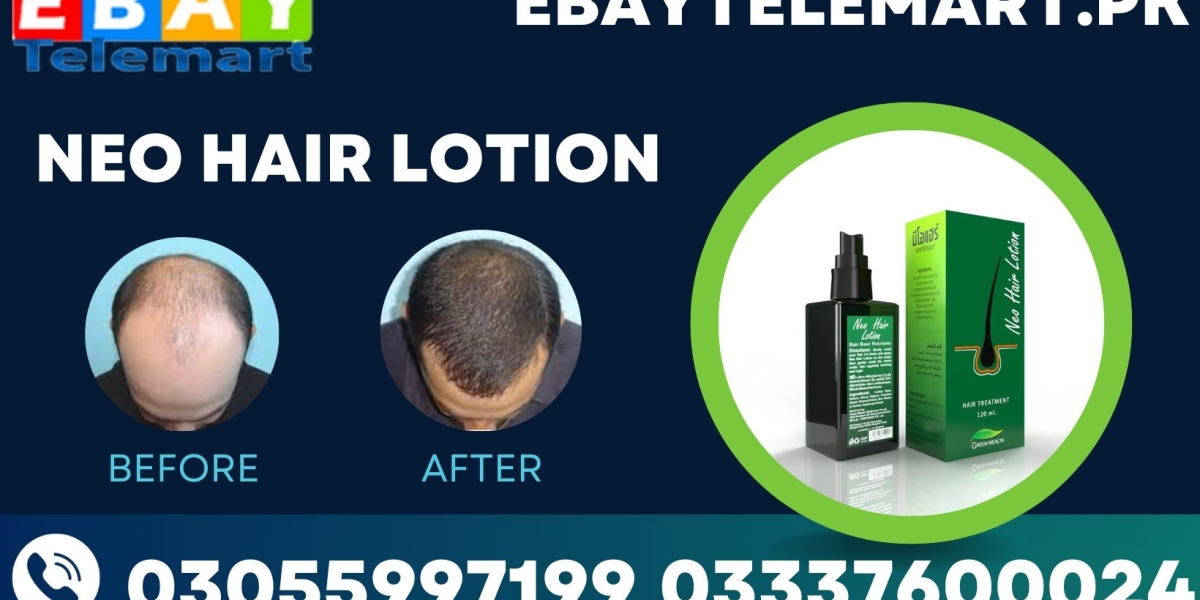 Green Wealth Neo Hair Lotion Price In Pakistan | 03337600024