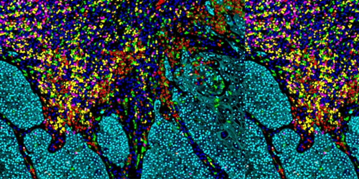 Multiplex Biomarker Imaging Market Size, Share, Growth Report 2030