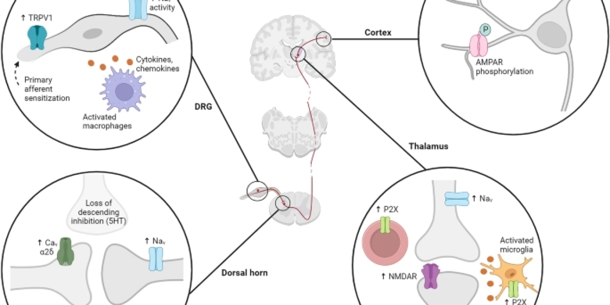 Understanding Central Neuropathic Pain: Unraveling the Intricacies of a Complex Condition