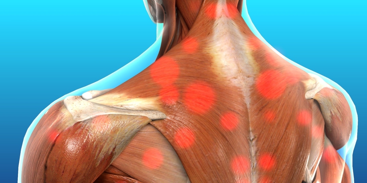 Expert Advice For Fast Shoulder Blade Pain Relief