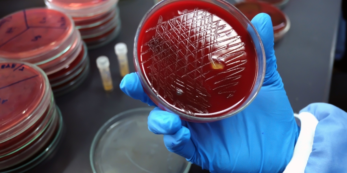 Blood Culture Tests Market Trends and Dynamics by 2030