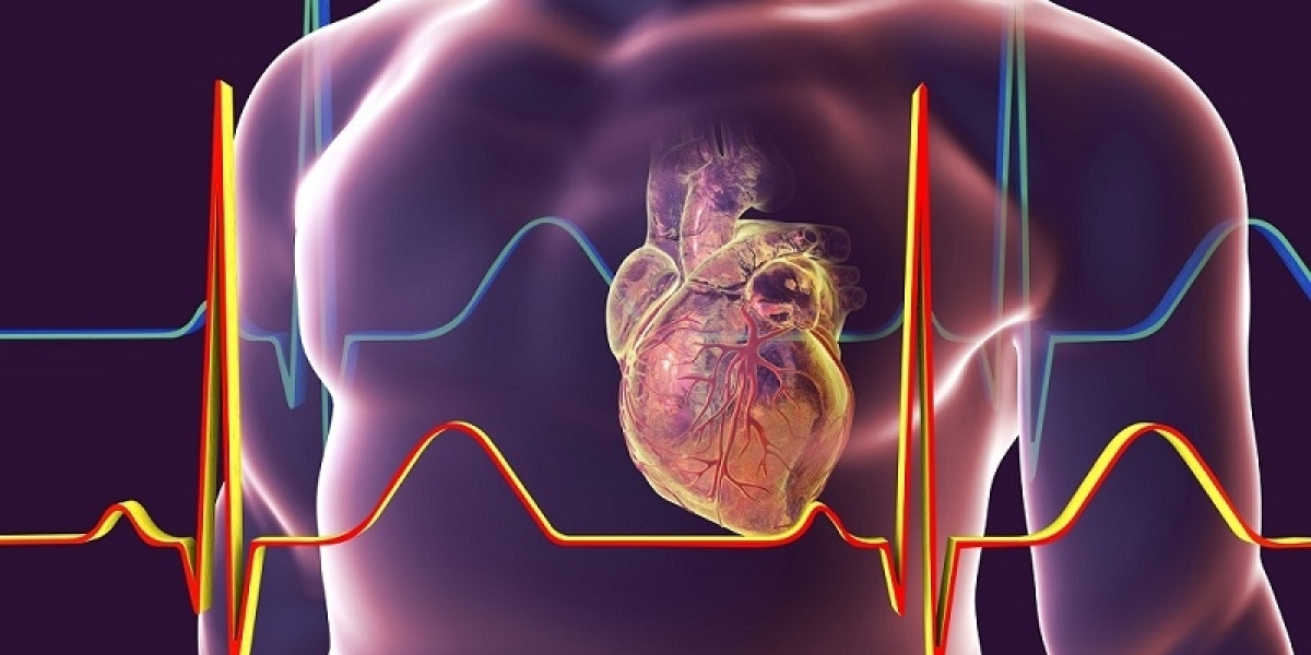 Cardiology Electrodes: Essential Tools for Diagnosing Heart Conditions