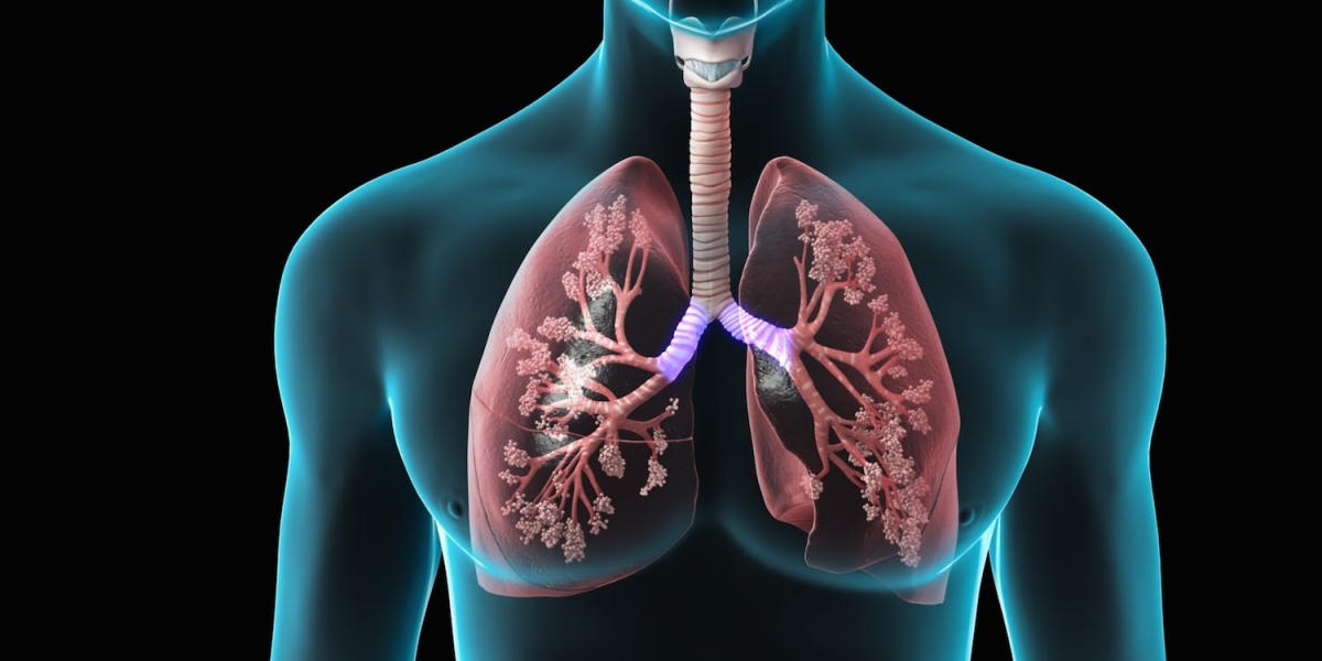 Advances in Chronic Obstructive Pulmonary Disease Treatment