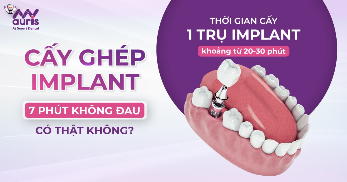 Quy trình cấy ghép Implant 7 phút không đau - Nha Khoa My Auris