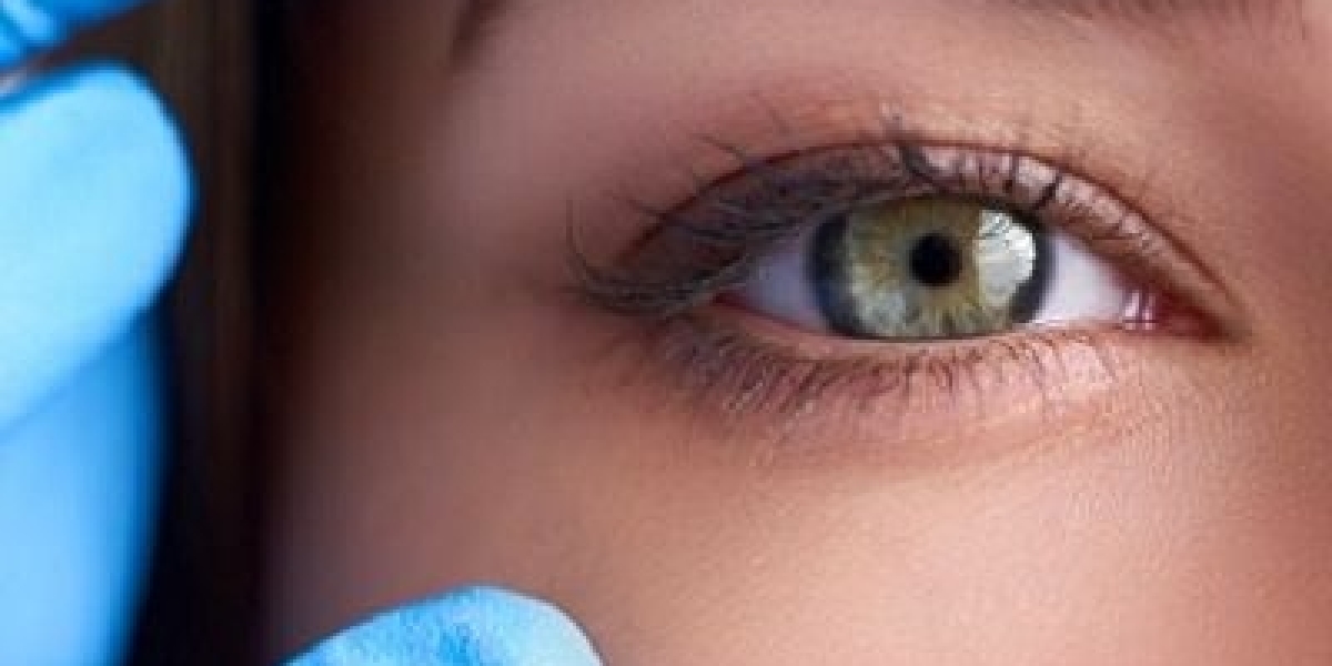 Eyelid Surgery in Dubai: The Ultimate Guide