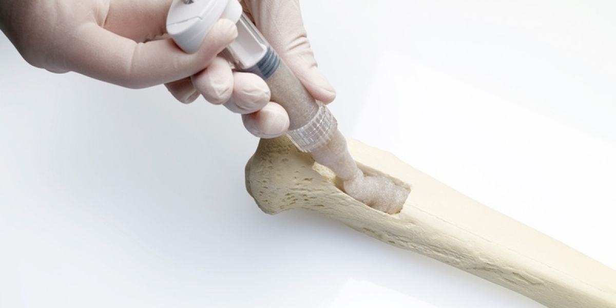 From Synthetic to Bioactive: A Look at the Growth Drivers of the Bone Graft Substitute Market