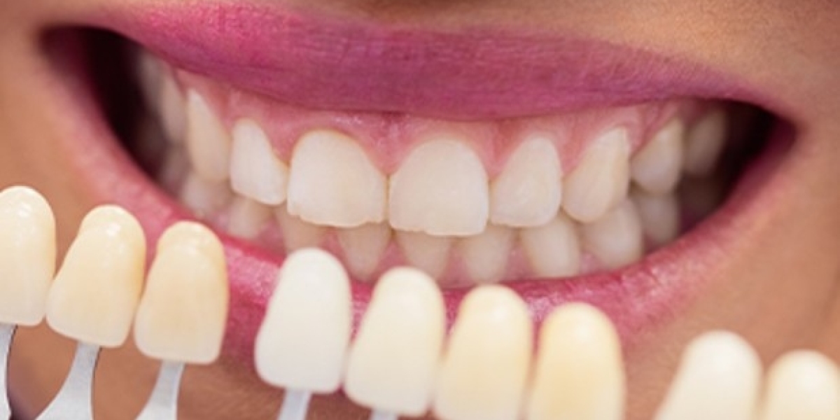 Experience the Brilliance of Zoom Teeth Whitening in Dubai