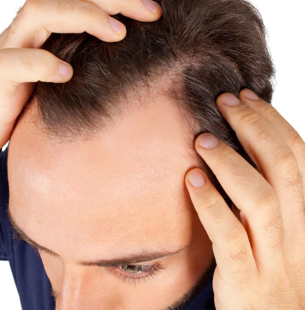 Will I experience any pain or discomfort during the recovery period of the FUE hair Transplant in Dubai? | by Eishadynamic | May, 2024 | Medium