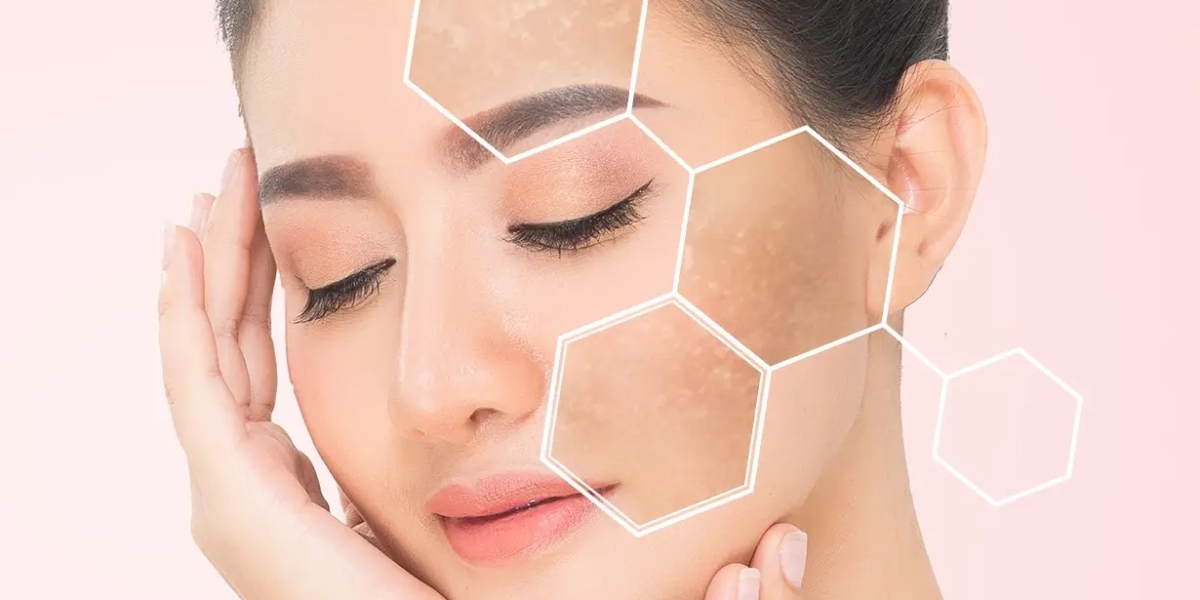 Exploring the Latest Trends in Dermal Pigmentation in Dubai