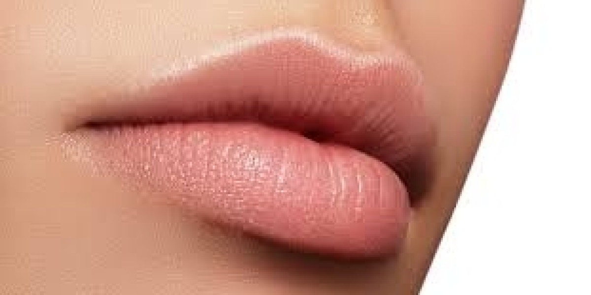 Achieve the Perfect Pout with Botox Lip Flip in Dubai