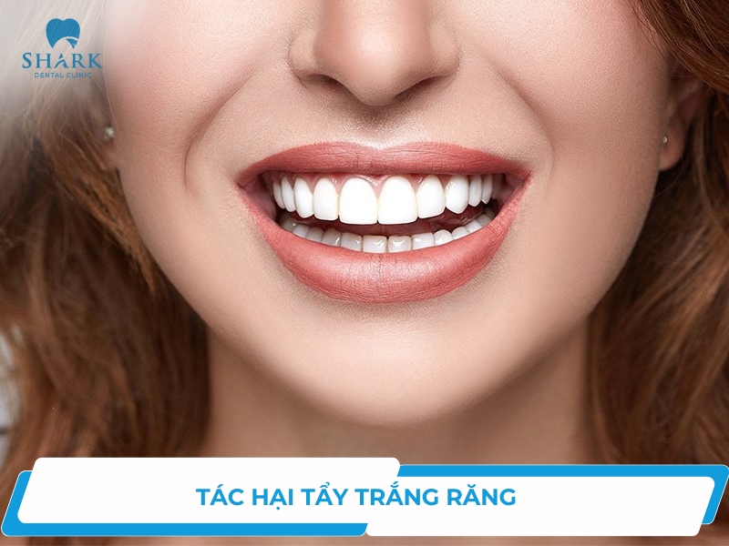 Những tác hại tẩy trắng răng bạn cần biết