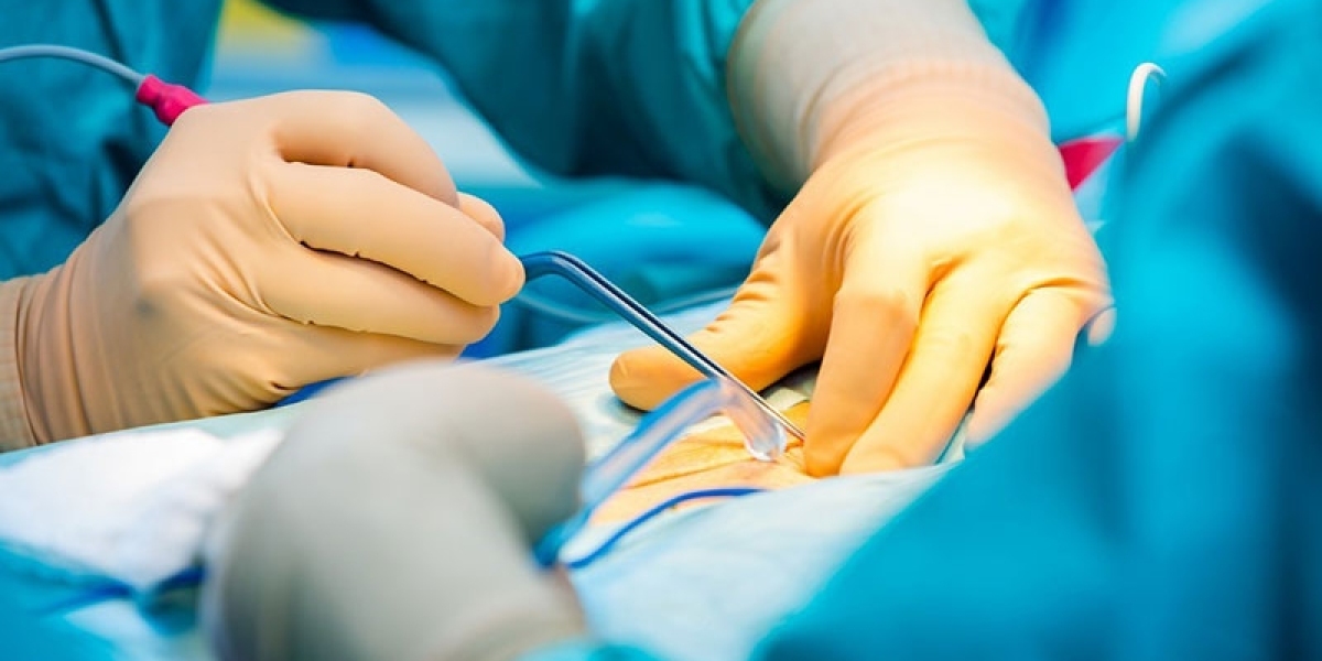 Electrosurgical Devices Market: Competitive Landscape