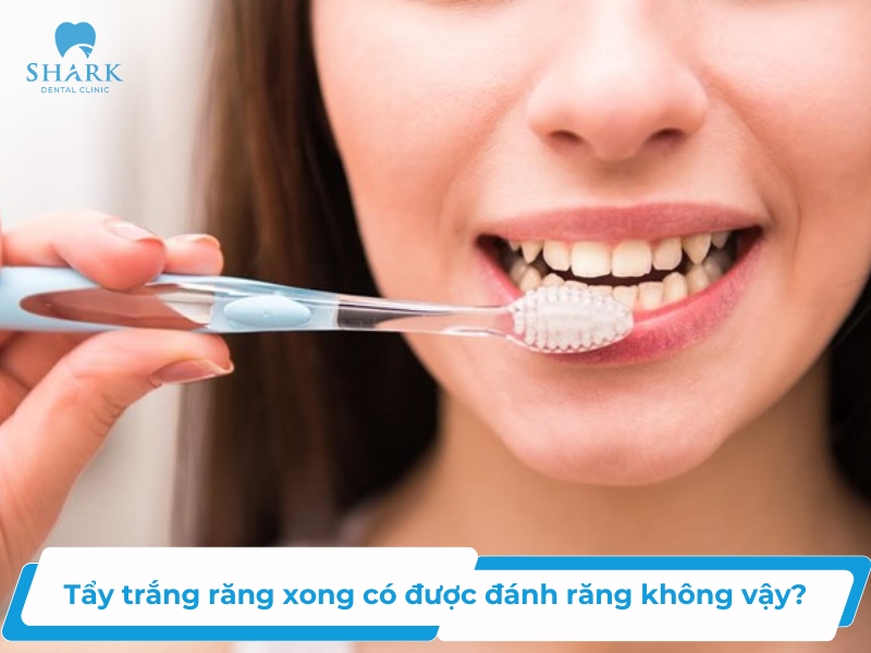 Tẩy trắng răng xong có được đánh răng không vậy?