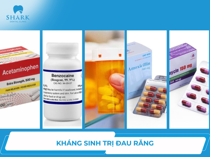 9 loại thuốc kháng sinh trị đau răng cực hiệu quả