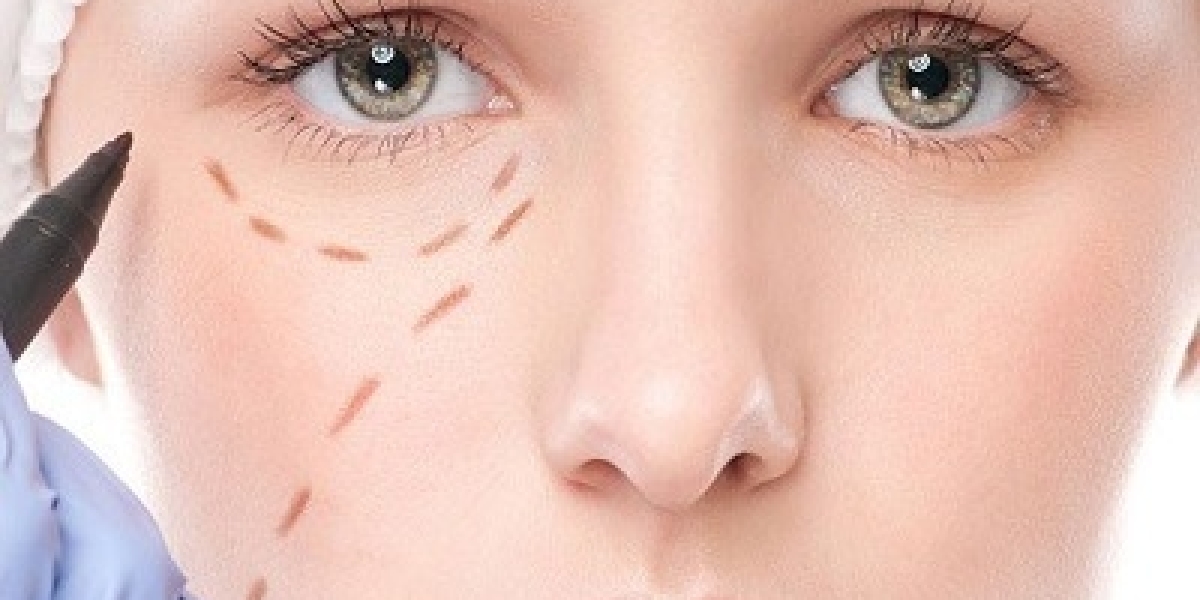 Top Eye Bag Removal Services in Dubai