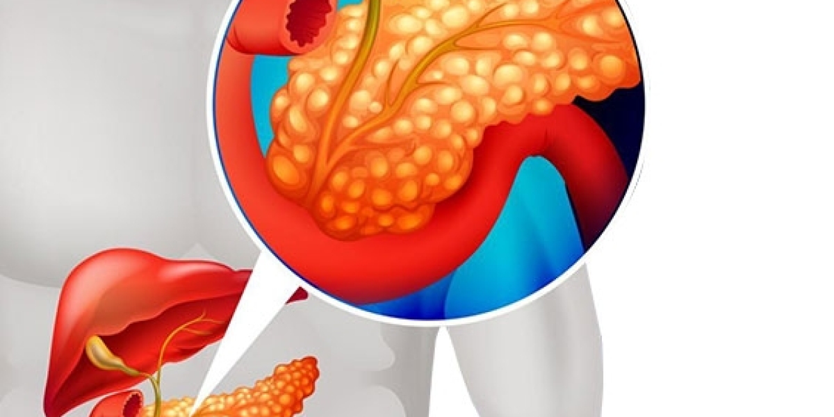 Pancreatic Cancer Market: Analysis of Epidemiology, Industry Trends, Size, Share, and Future Forecast (2024-2034)