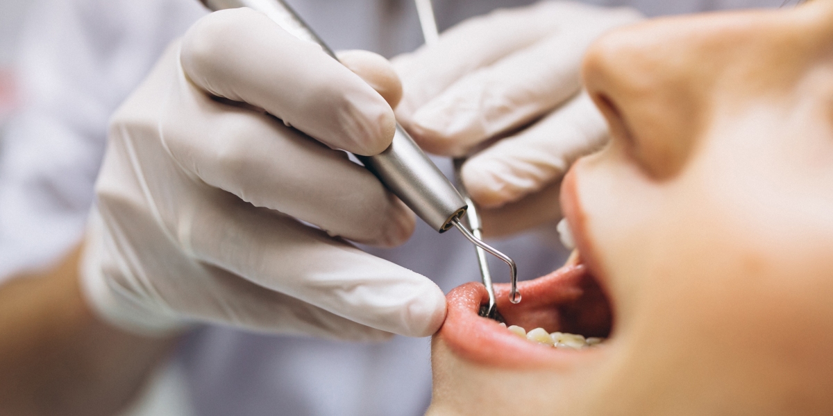 Top Benefits of Choosing Root Canal Treatment in Grantham for Dental Health