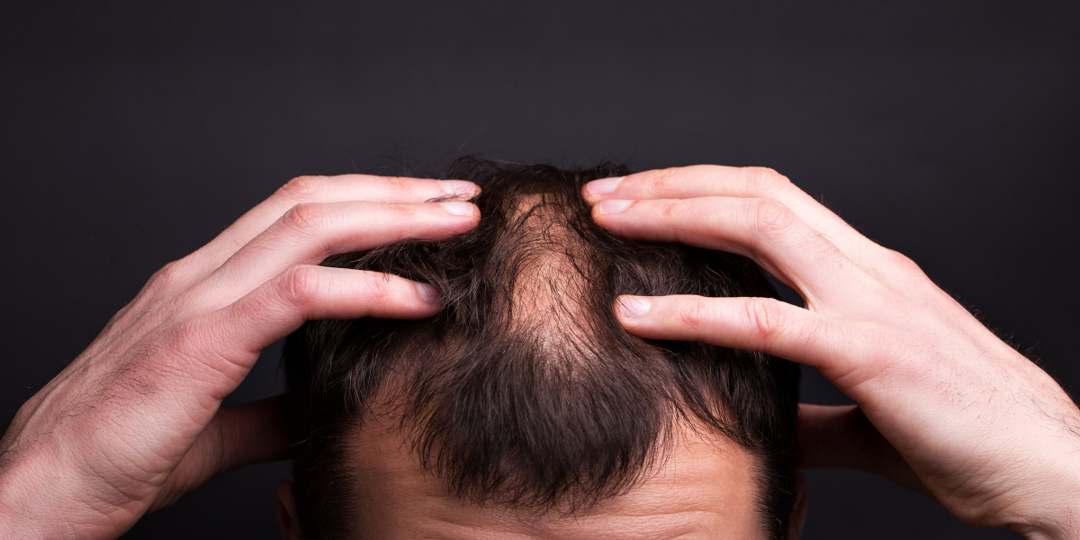 Can hair loss be environmental?