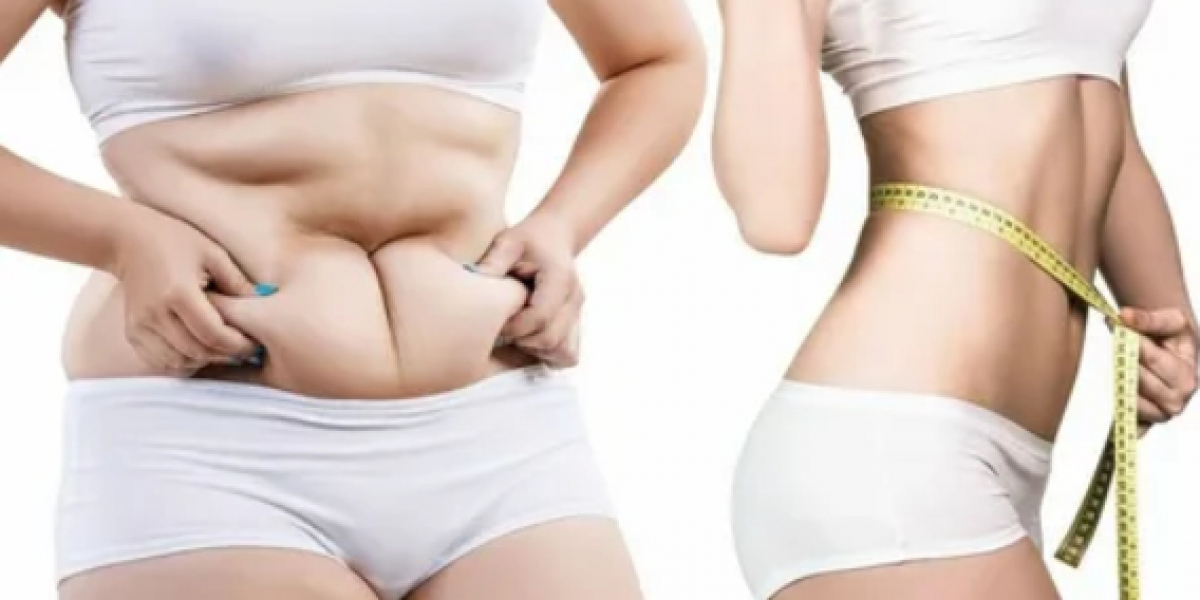 Body Contouring Treatment and Its Various Benefits