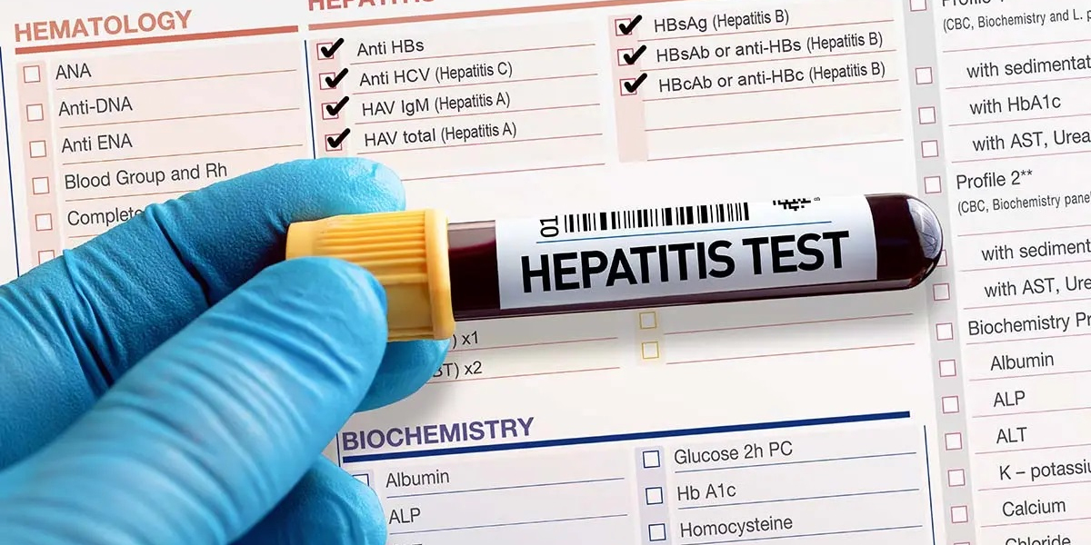 Hepatitis Test Solution Diagnosis Market Soars: A Comprehensive Overview