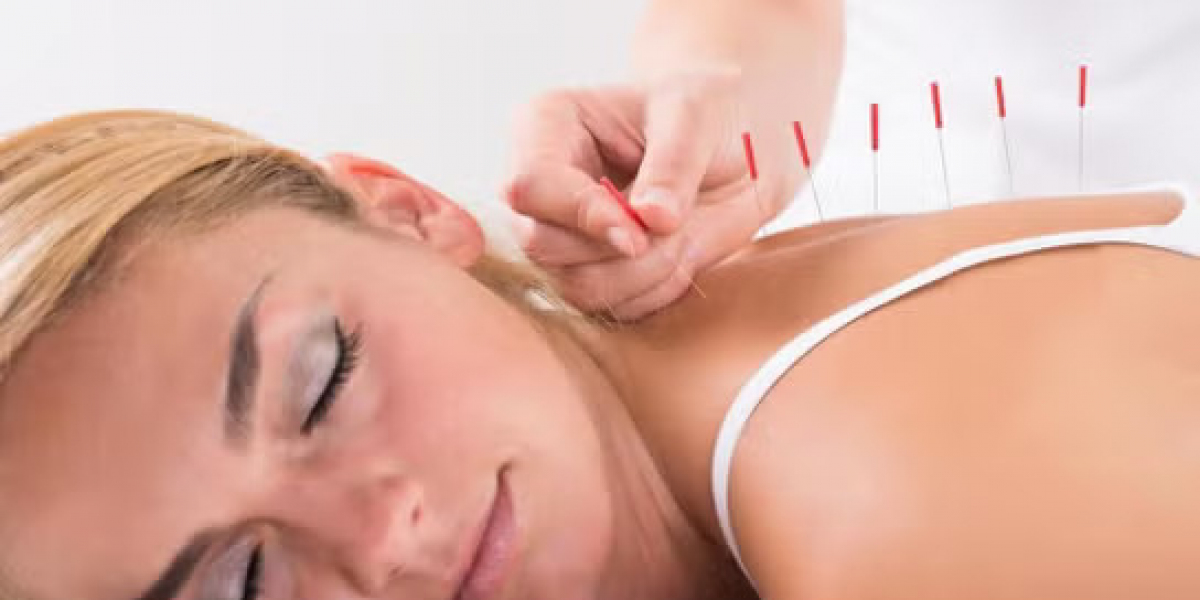 Best Acupuncture in San Francisco - Dao Integrated Health