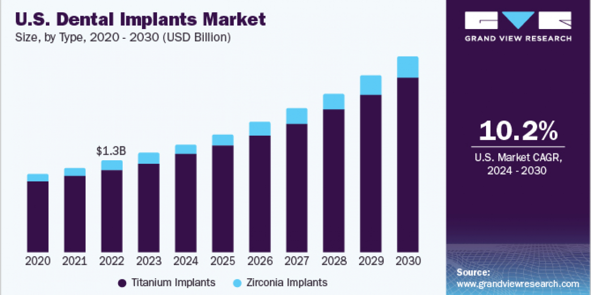 Dental Implants Market 2030: The Importance of Digital Connectivity