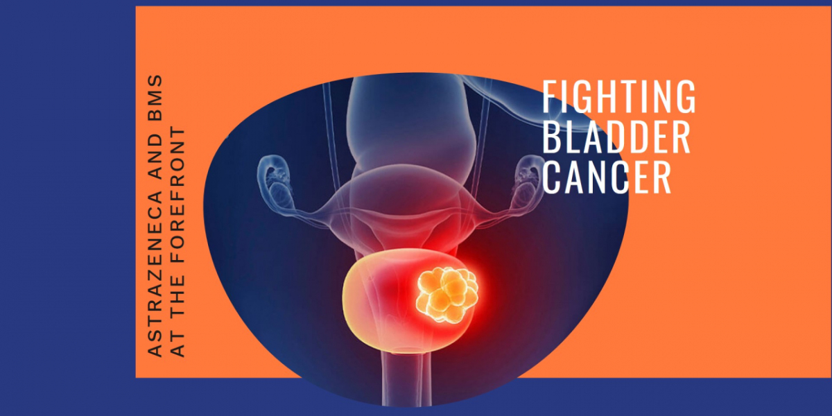 Breakthroughs in Bladder Cancer Diagnosis and Treatment