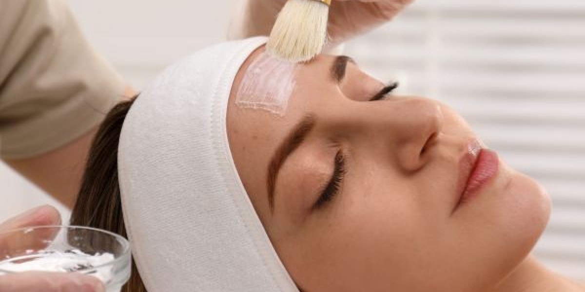 How to Choose the Right Chemical Peel for Your Skin Type