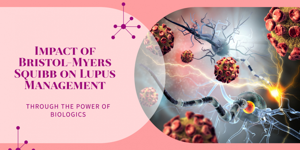 Lupus Care: Aurinia Pharmaceuticals’ Breakthrough in Treatment Innovations