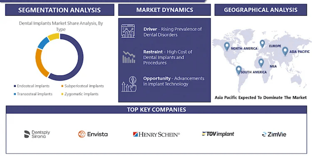 A Quick Overview of Dental Implants Market Trend for 2032