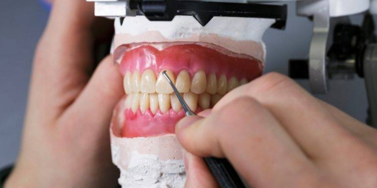 Enhance Durability and Precision with Full Metal Crowns from Puche Dental Labs