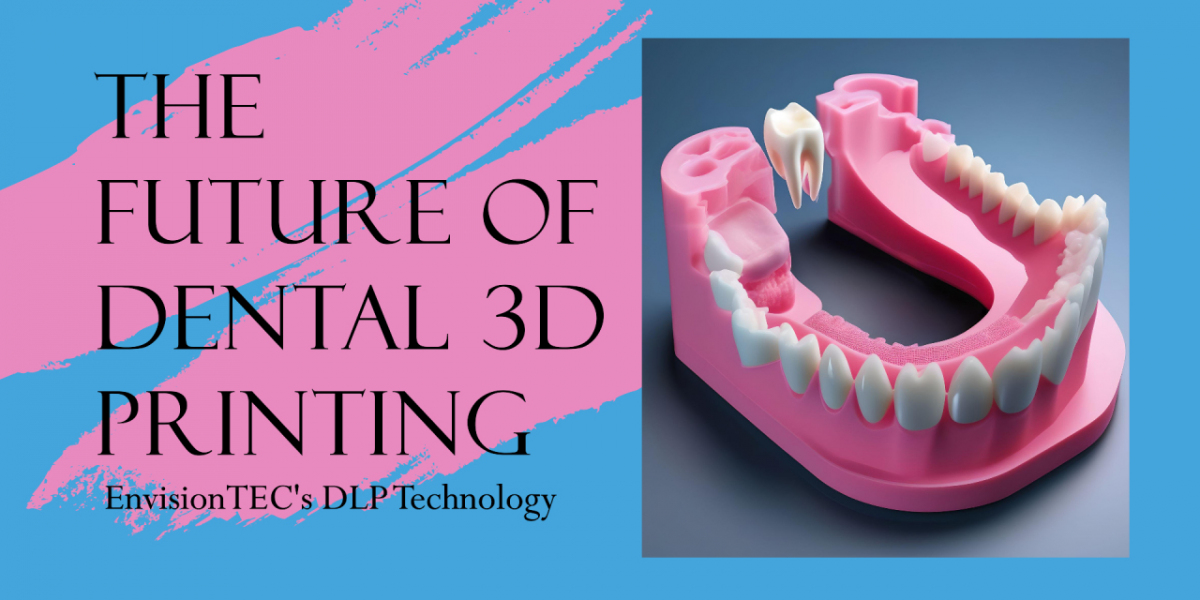 Top 5 Innovations Driving the Dental 3D Printing Market Growth in 2024