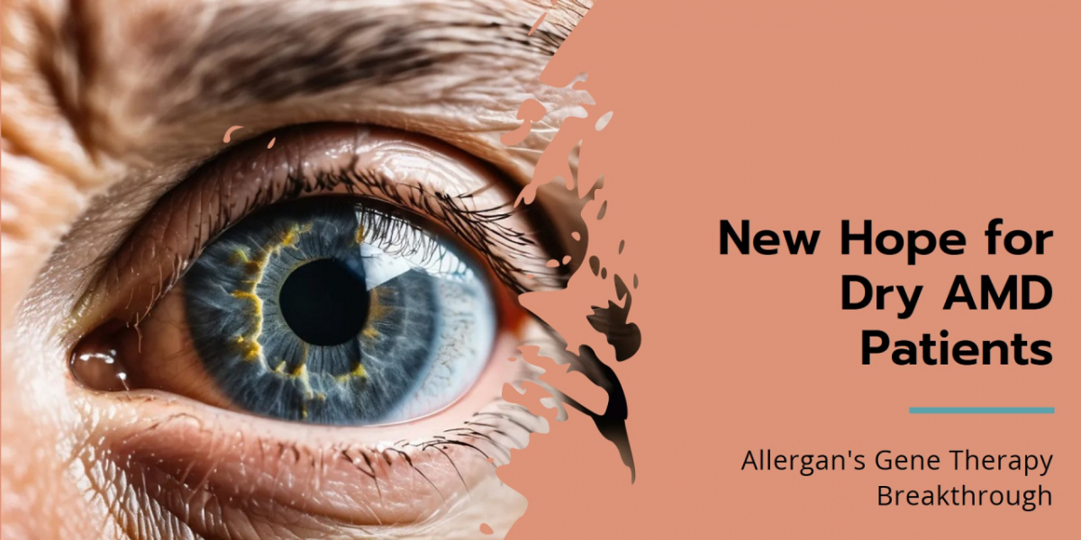 Dry AMD Treatment Breakthroughs: Santen, Allergan, and the Path to Cures