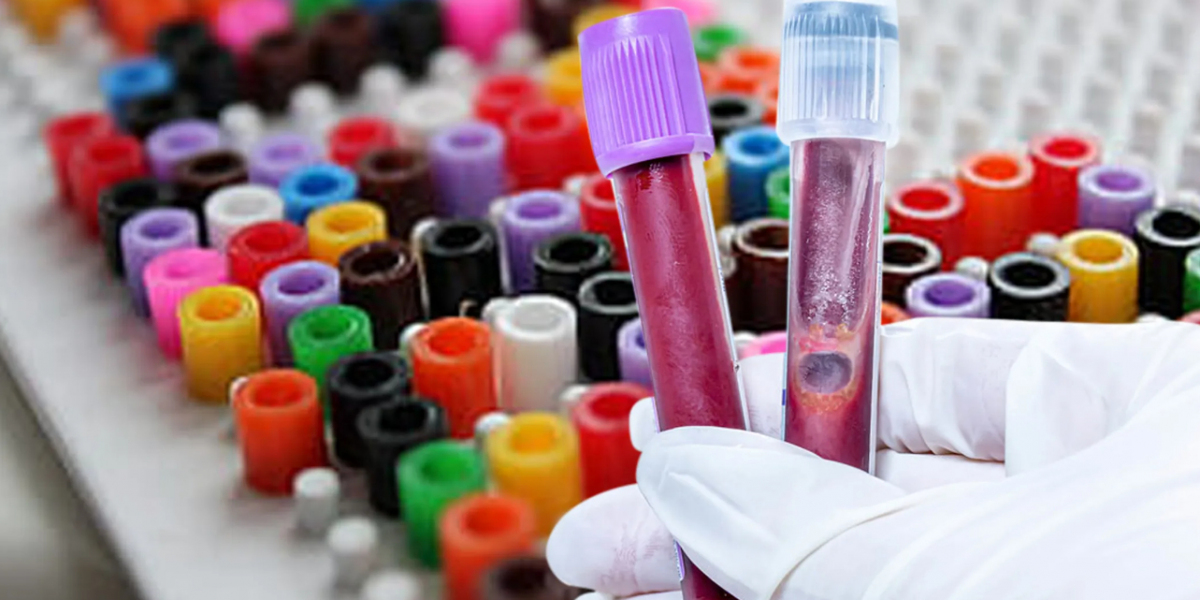 Global Blood Collection Tubes Market Sees Steady Growth Driven by Increased Testing