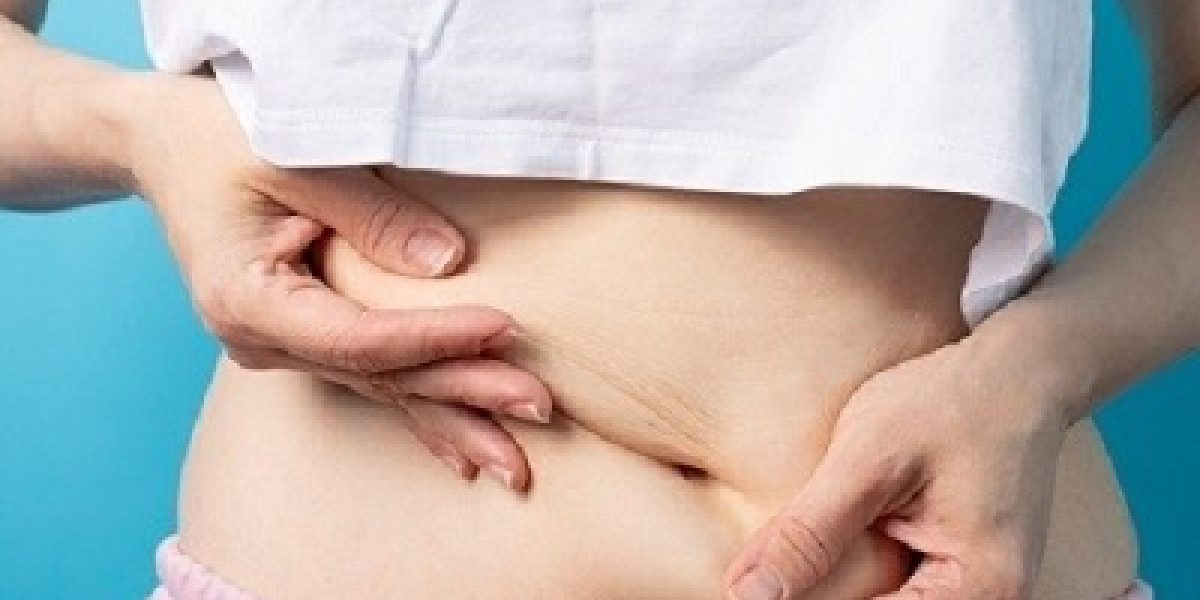 Popular Liposuction Techniques Available in Islamabad