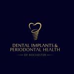 DENTAL IMPLANTS And PERIODONTAL HEALTH