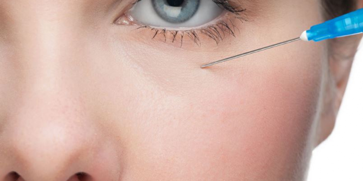 Tear Trough Fillers: What You Need to Know