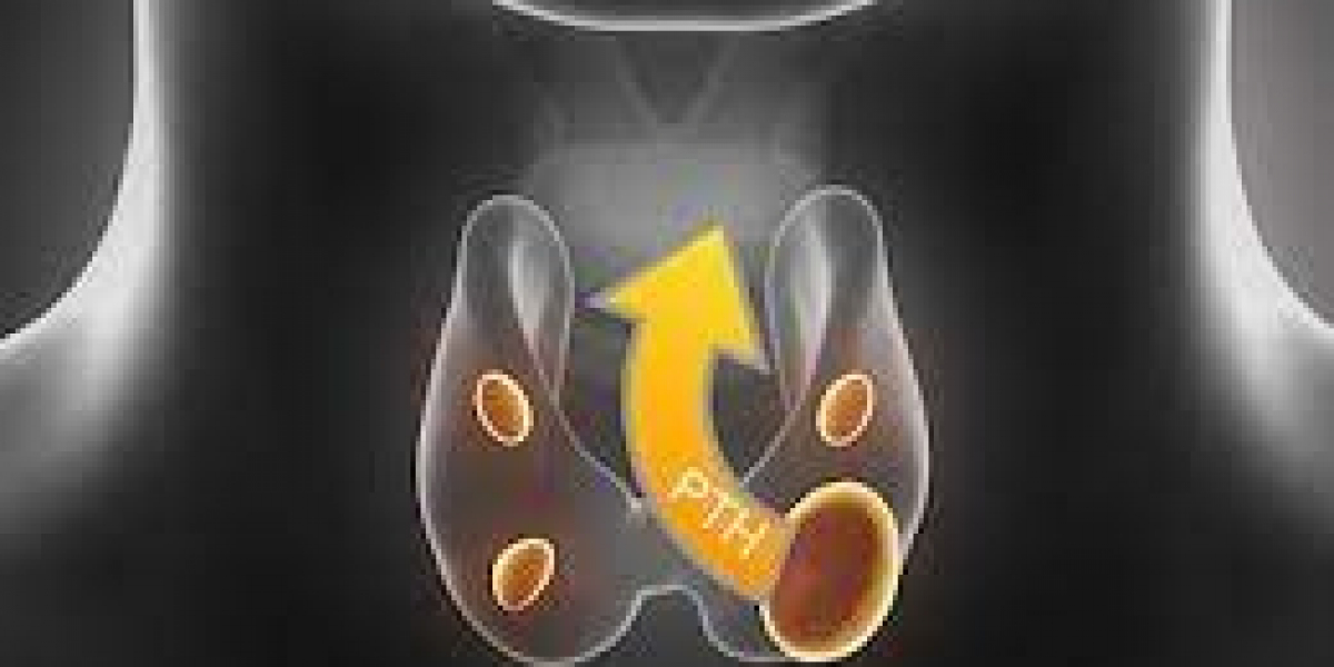 Hypoparathyroidism Treatment Market Size, Navigating Growth Opportunities and Forecasted Outlook from 2024-2032