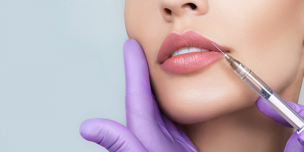 Top 5 Areas Treated with Dermal Fillers in Islamabad