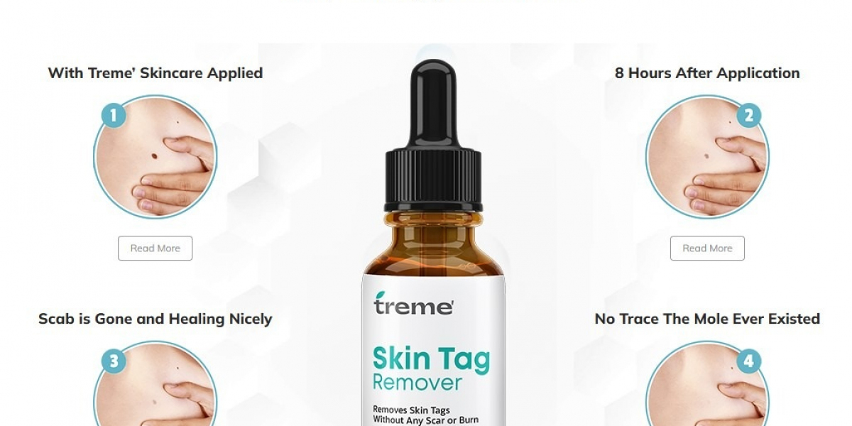 Treme SkinTags, Moles & Wart Remover: Ingredients, Facts, Price & Benefits